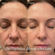 SkinLumi - BeautyStift