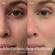 SkinLumi - BeautyStift